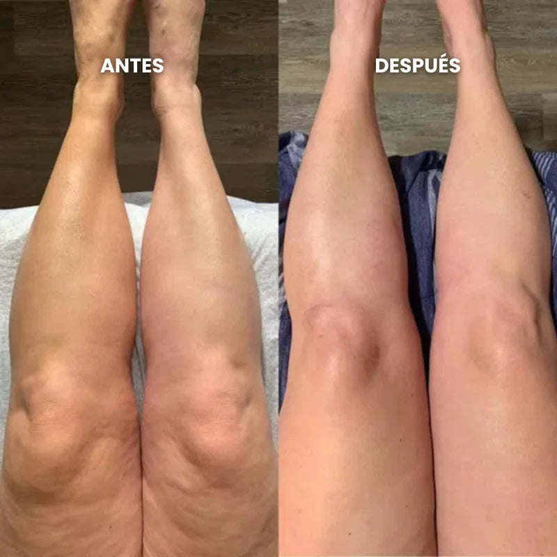 Situación cotidiana de piernas cansadas al final del día