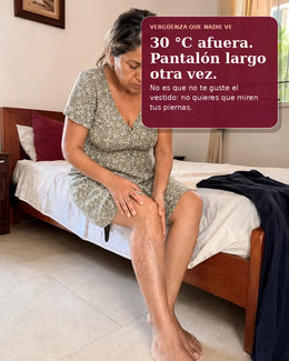 Mujer observando várices visibles antes de vestirse