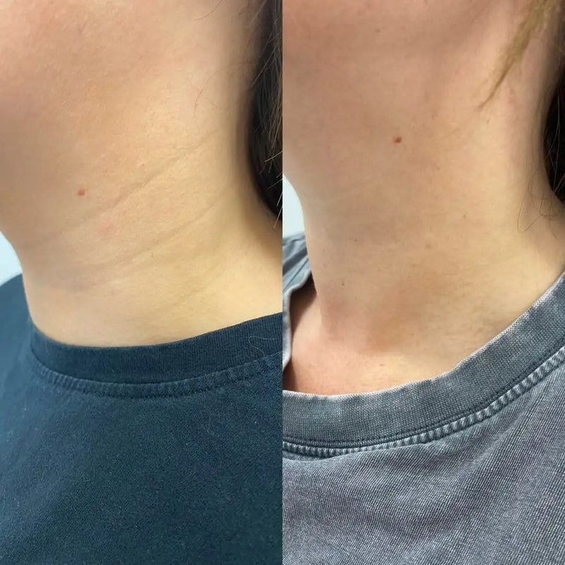 Mujer cuidando la piel de su cuello.