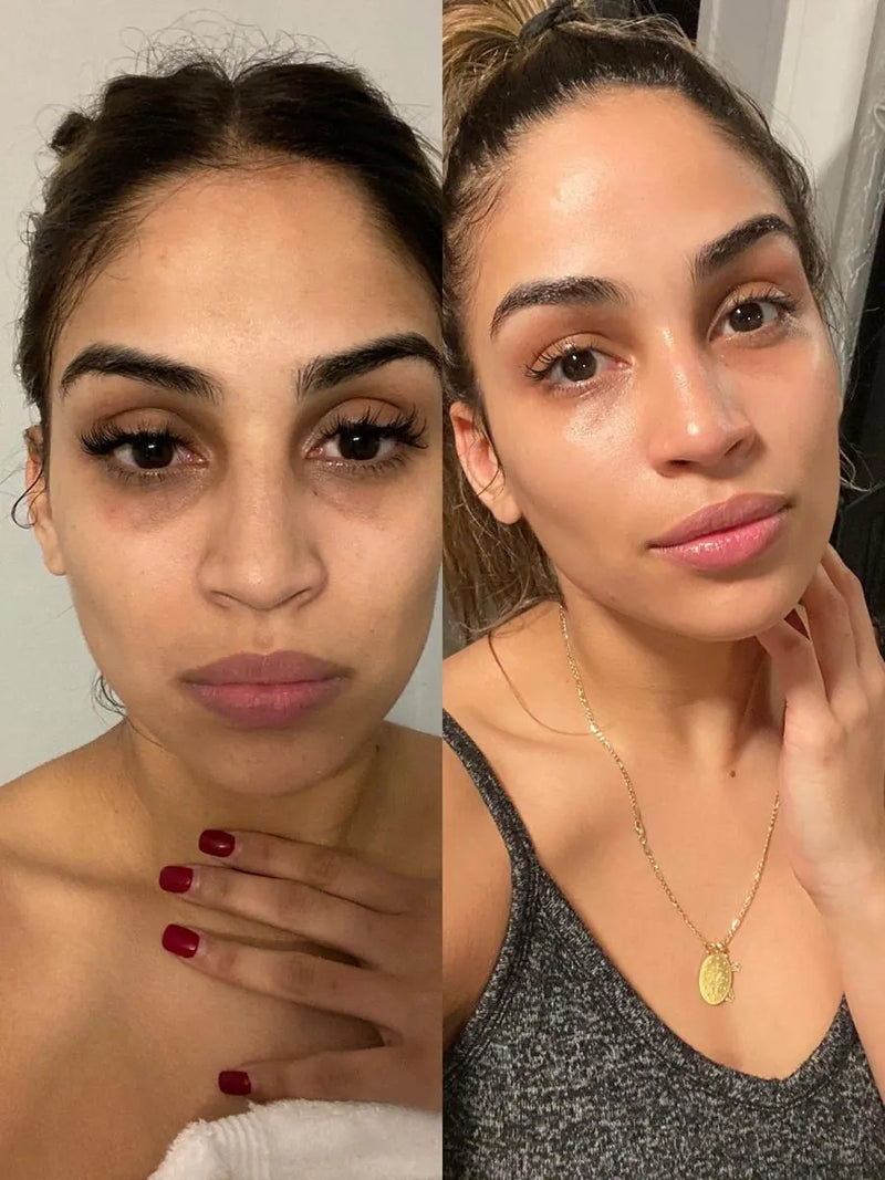 Mujer señalando suavemente el área exterior bajo el ojo.