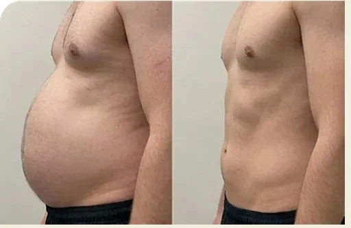 Mujer notando hinchazón abdominal por la tarde